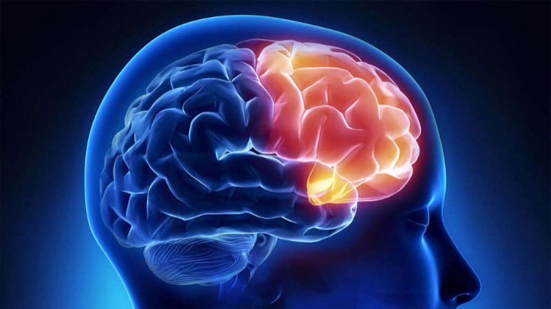Brain Disorders