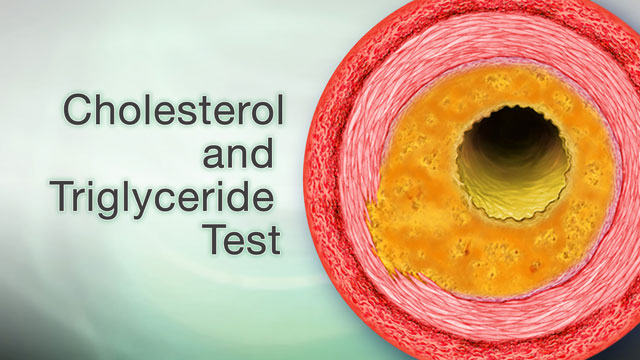 High blood cholesterol and triglycerides