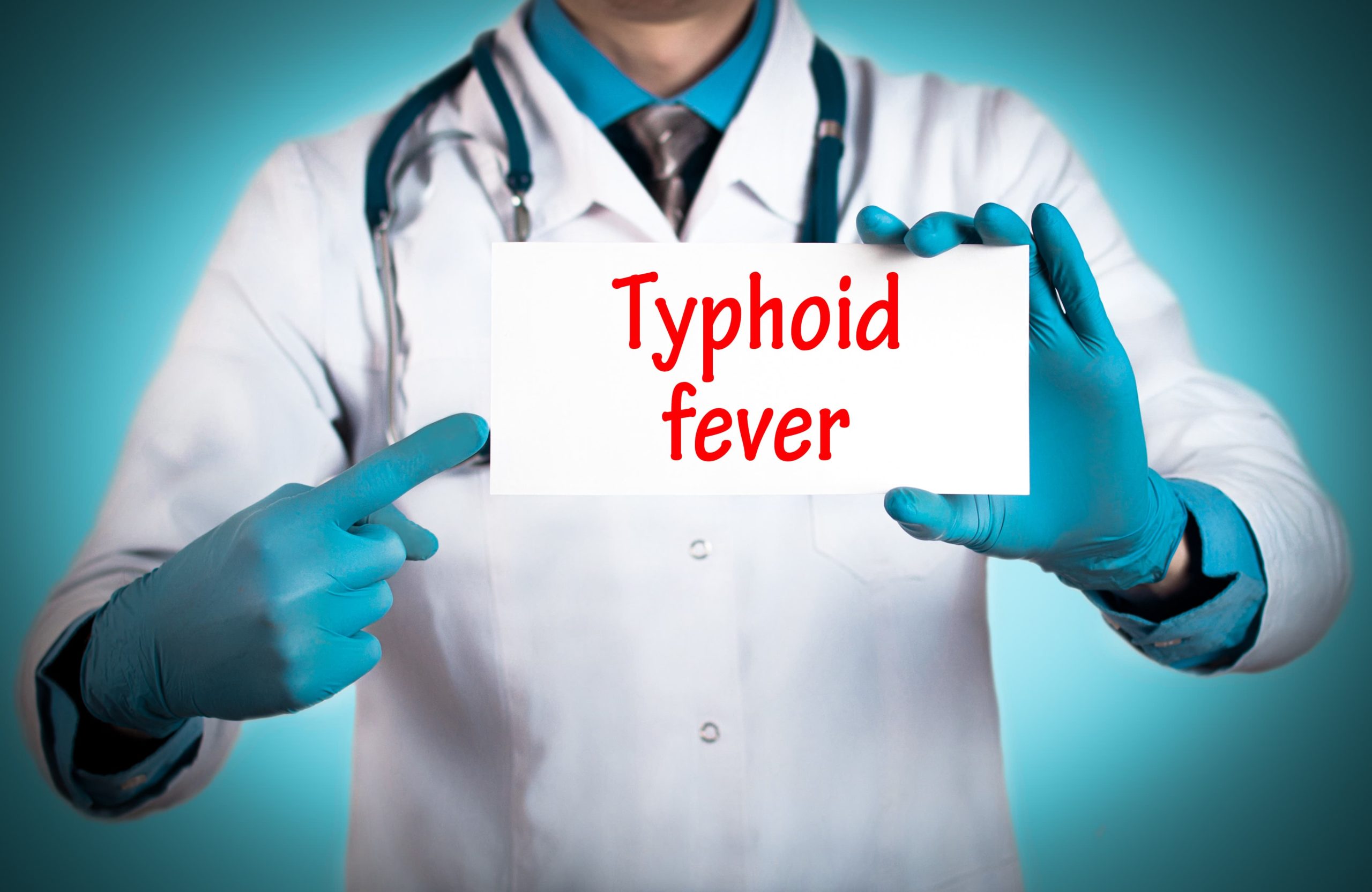 Typhoid fever