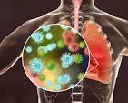 Acute respiratory infections